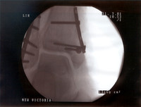 xray4