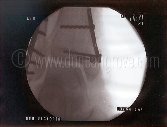 xray4