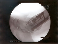 xray1