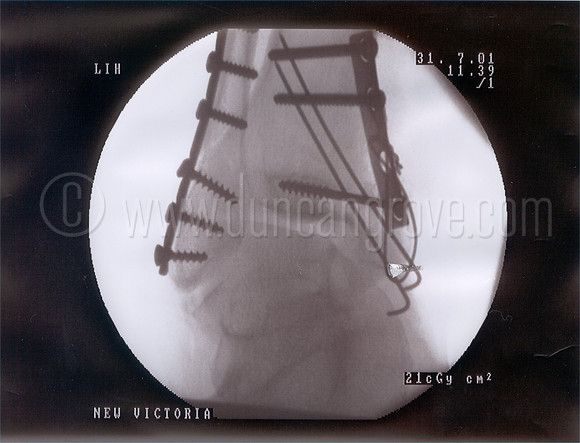 xray2