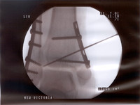 xray3