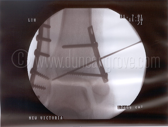 xray3